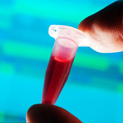 FDA Onaylı Test Laboratuvarları Gıdayla Temas Eden Hızlı Tespit Biberon Üçüncü taraf kimlik doğrulama hizmeti